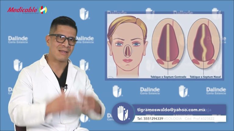 Sintomas Tabique Nasal Desviado Nevosurgeryes 9600